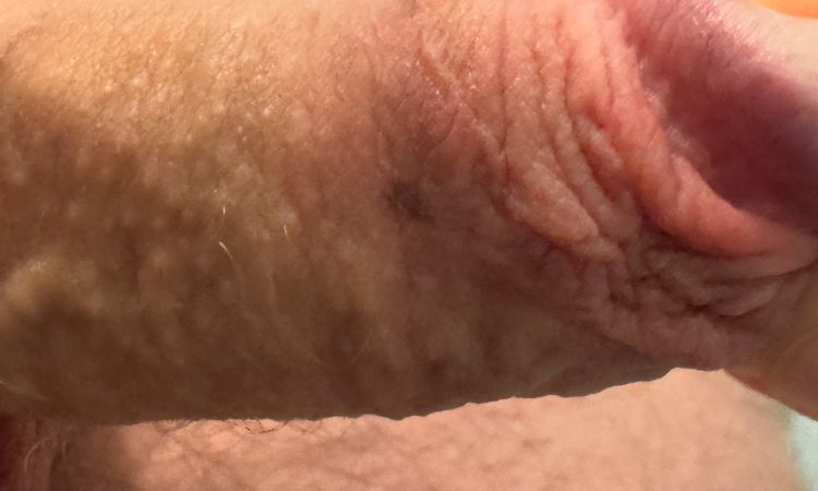 Nachbeschneidung oder Korrektur möglich ? - 80083