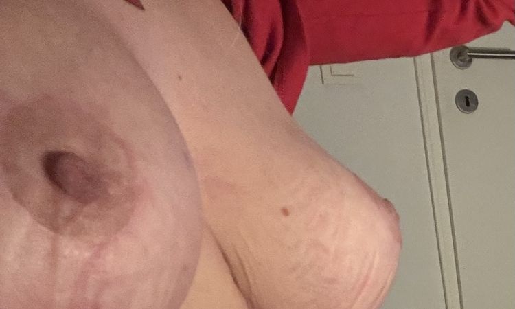 Probleme nach bruststraffung mit Implantat - 80667