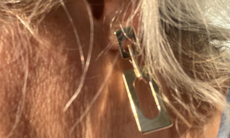 Ultherapie, nach 4 Woche Ergebnis, was nun? - 81159