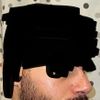 Delle am Knochen-Knorpel-Übergang 3½ Monate post-OP