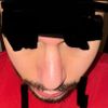 Delle am Knochen-Knorpel-Übergang 3½ Monate post-OP