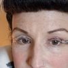 Dicke Wulst am Schnitt
