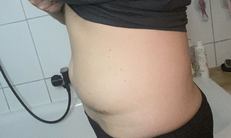 Asymmetrischer Bauch - 81749