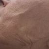 Fadenlifting Gesicht