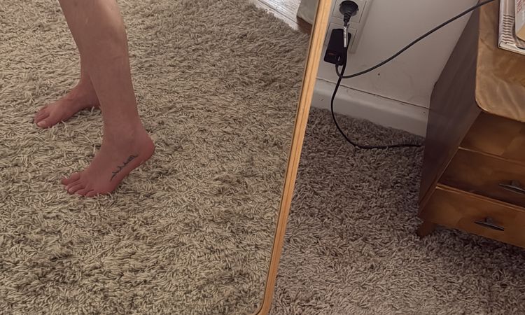 Dellen nach Liposuktion - 81849