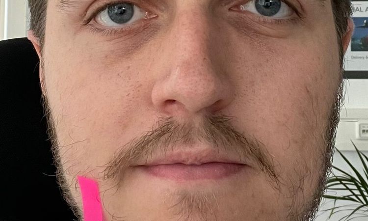 Hat die Asymmetrie meiner Augen einen Grund / Gibt es eine Behandlung? - 82170