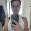 Abstehende ohren und fehlender haaransatz nach hals facelift