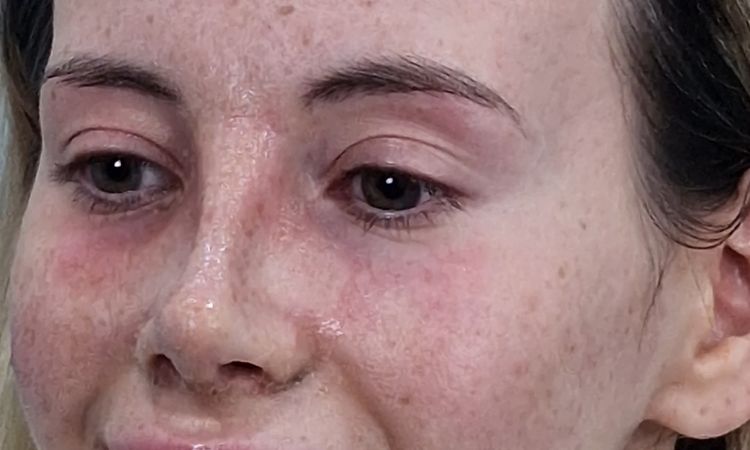 Wie ist Ihre Einschätzung zu meiner Nase ? - 82798