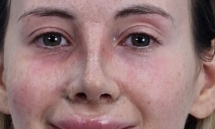 Wie ist Ihre Einschätzung zu meiner Nase ? - 82799