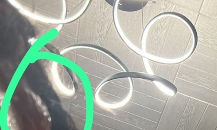 Offene Wunde 4 Monate nach Schläfenlift - 82871