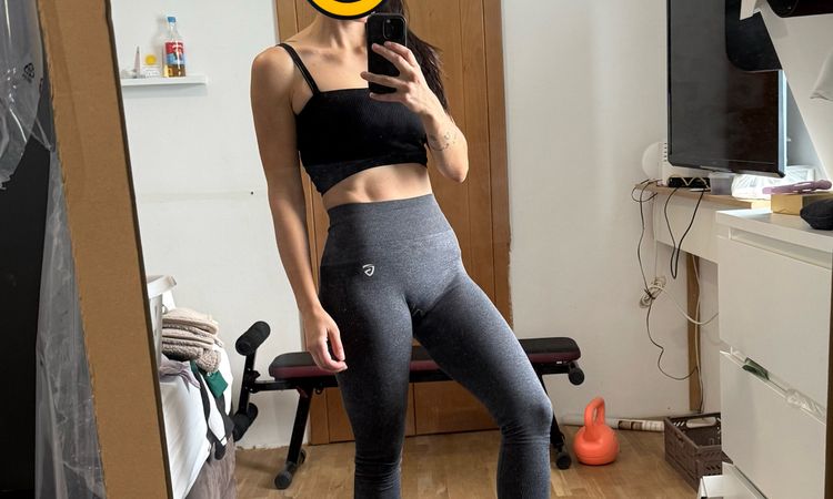 Bruststraffung mit Implantaten– ist 400 cc Mentor High Profile sinnvoll? - 82893