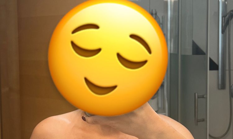 Linke Brust sitzt höher nach Capsulectomie - 82988