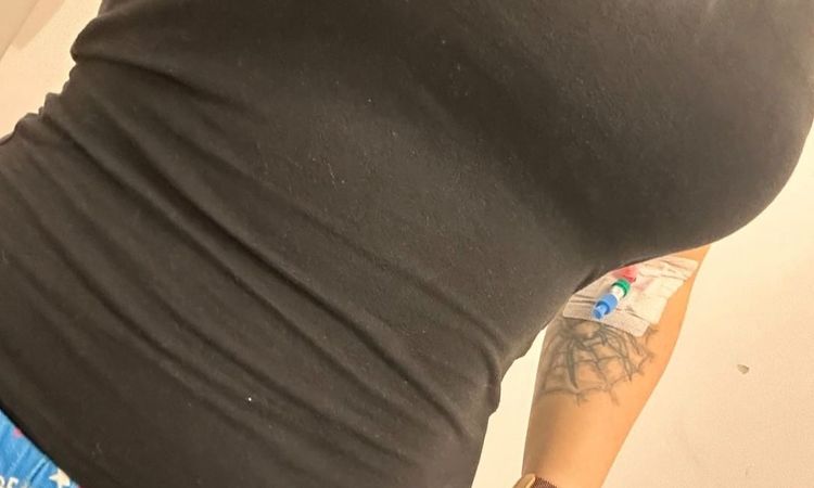 Bekomm ich ein gutes Ergebnis? Brustvergrösserung ohne Straffung - 83190