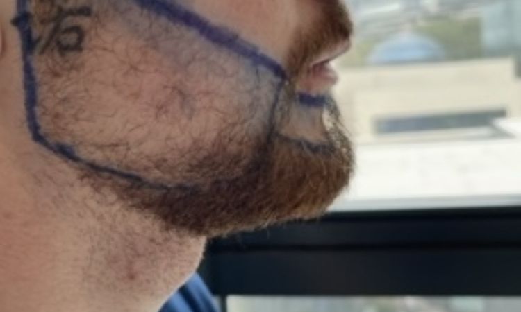 Markantere Gesichtszüge - 83212