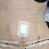 Ich habe Angst das der bauch später wieder hängt