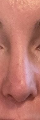 Nase ist zu klein, wie vergrößern - 83518