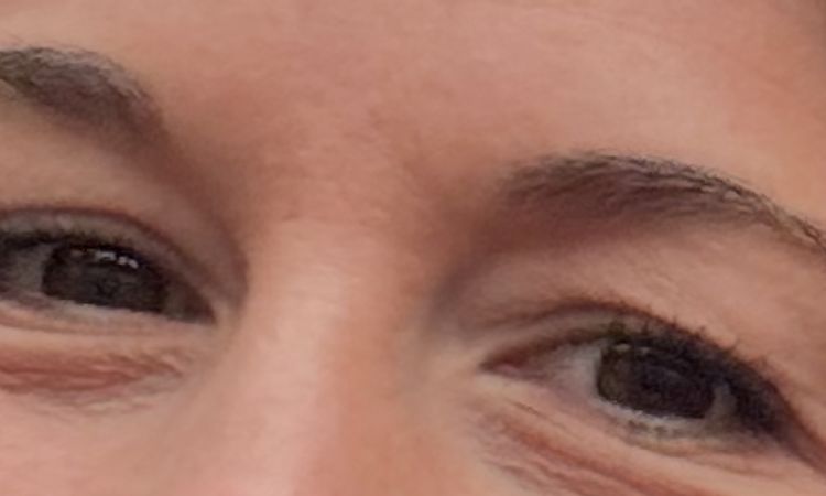 Augenringe behandeln/verbessern - 83568