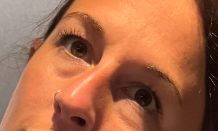 Augenringe behandeln/verbessern - 83570