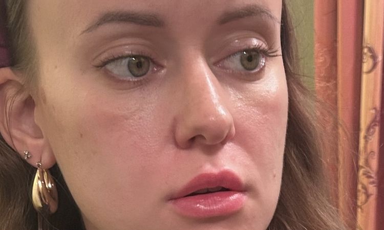 Wer bietet eine Doxycyclin-Behandlung gegen Malar Bags an? - 83613