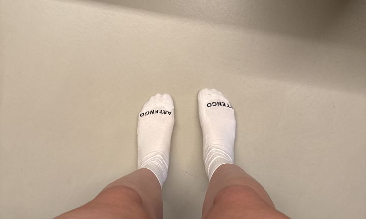 Delle nach liposuktion am Oberschenkel - 83692