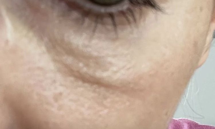 Wie fühlt sich hyaluron an? - 83759