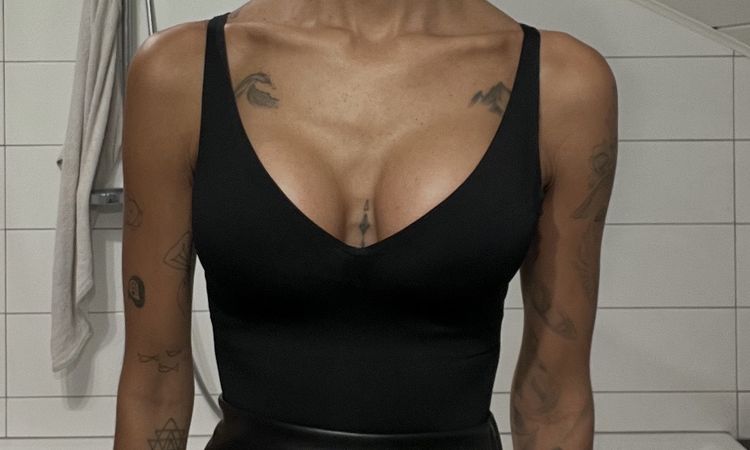 Brustimplantate 8 Wochen nach Operation ungleich - 83766