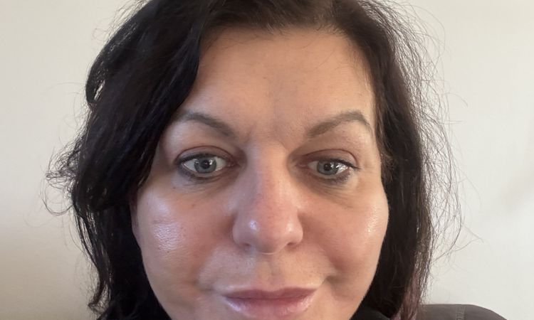 Nachsorge nach SmasNecklifting ? - 83795