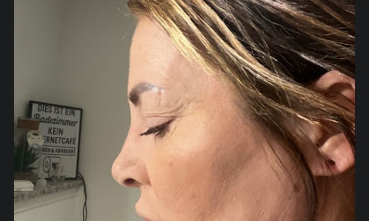 Keine Kinnlinie mehr - 83848