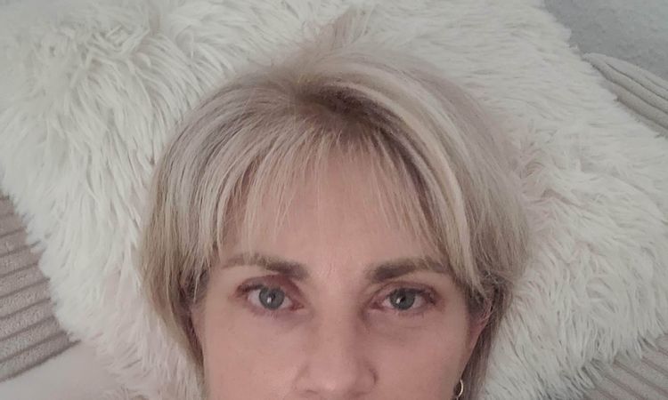 Hatte am 3.6. eine blepharoplastik - 84595