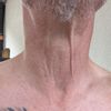 Was ist für meinen Hals machbar?