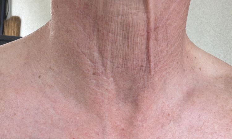 Was ist für meinen Hals machbar? - 84658