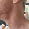 Was ist für meinen Hals machbar?