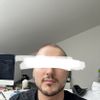 Bichektomie brachte nicht gewünschte Erfolge.
