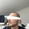 Bichektomie brachte nicht gewünschte Erfolge.