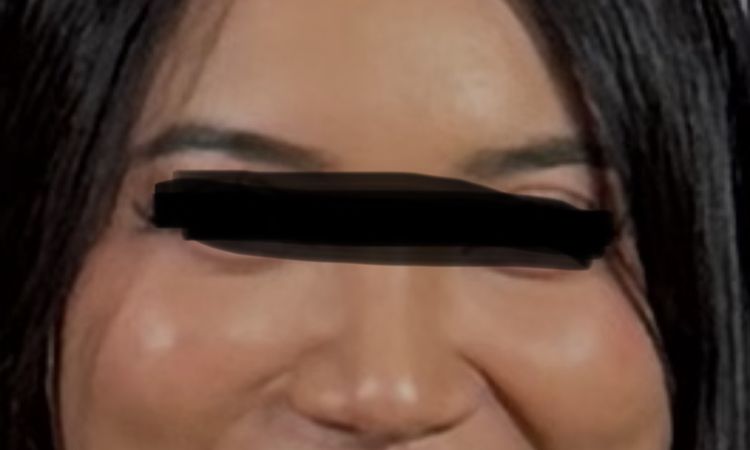 Rundes Gesicht schmälern - 84790