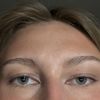 welche Behandlung wäre sinnvoll?