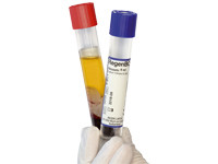 Regen ATS  Regen ATS