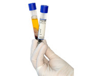 Regen PRP® Regen PRP®