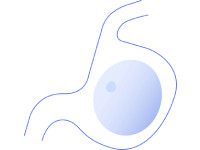 Allurion Ballon Allurion Ballon