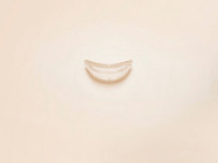 Sebbin Gesichtsimplantate Sebbin Gesichtsimplantate