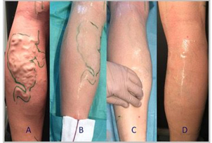 Wie läuft die Behandlung ab