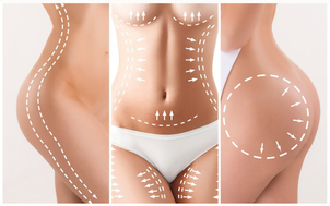 Lästiges Fett wird abgesaugt und in die Brust verpflanzt um diese zu vergrößern