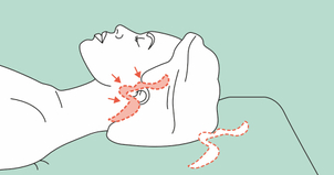 Entfernung überschüssiger Haut und Straffung - DGPRAEC