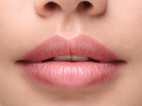 Volle, sinnliche Lippen dank der innovativen Methode des “Bullhorn Excision” 