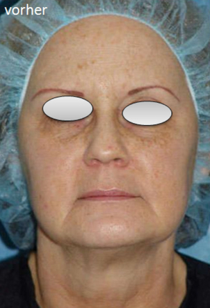 Foto: Dr. med. Nikolaus Linde