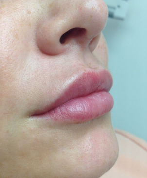 Behandlungsergebnis der Arteo Privatklinik GmbH