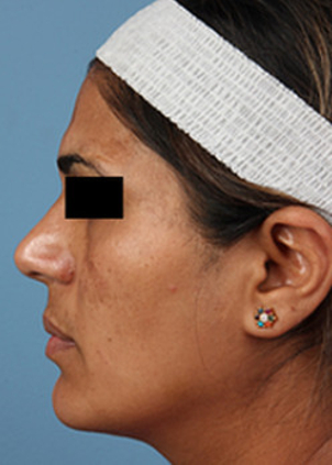 Auswahl des Spezialisten