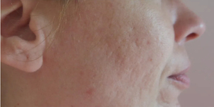 Vorher-Nachher Foto: Concept Clinic