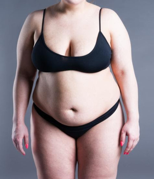 Die Sleeve-Gastrektomie ist eine der sichersten Techniken zur Bekämpfung der Adipositas bei Patienten mit einem Body-Mass-Index über 40.