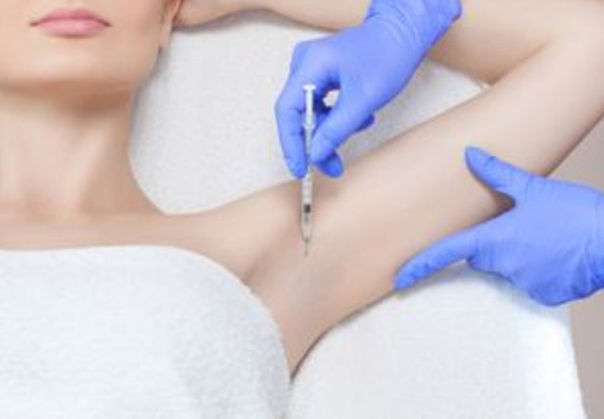 Eine der wirksamsten Methoden zur Behandlung von Hyperhidrose ist die Injektion von Botox